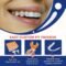 Custom Retainers for Teeth
