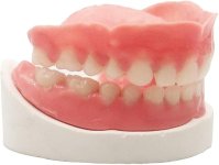DIY Full Denture Kit