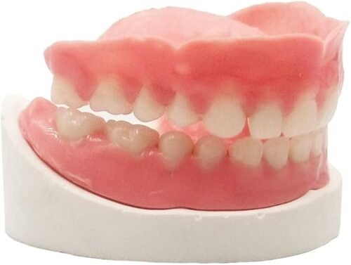 DIY Full Denture Kit