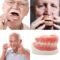 DIY Full Denture Kit