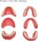 DIY Full Denture Kit