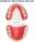 DIY Full Denture Kit